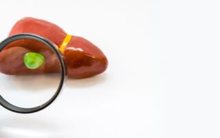 que pasa si se tienen piedras en la vesícula