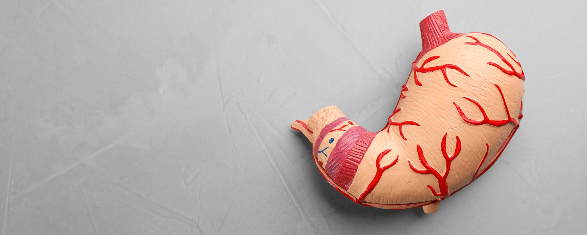 úlcera gástrica causas síntomas y tratamiento